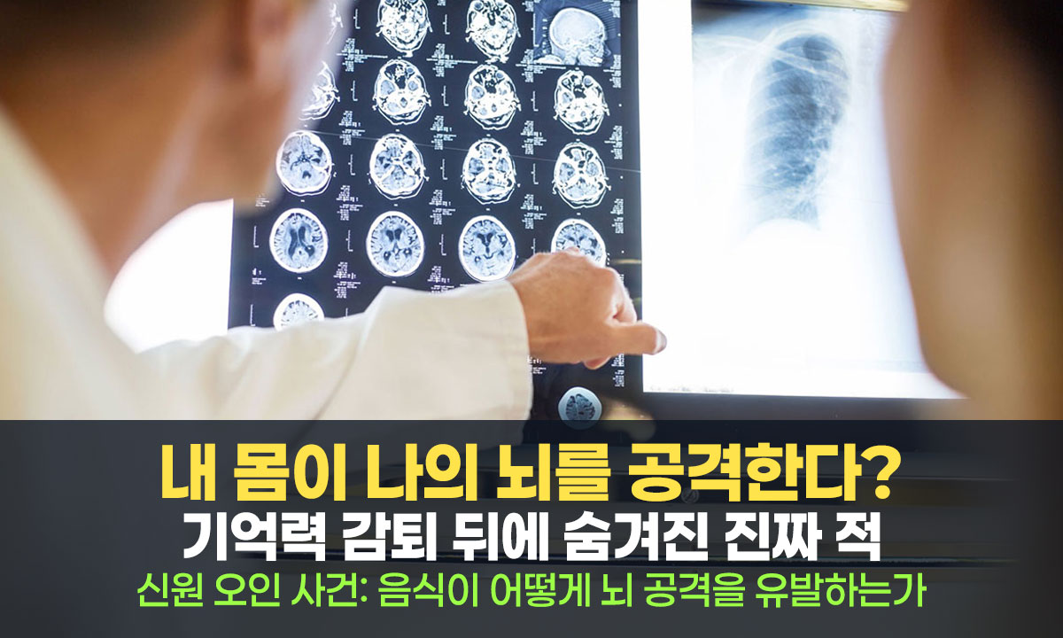 내 몸이 나의 뇌를 공격한다? 기억력 감퇴 뒤에 숨겨진 진짜 적, 자가면역